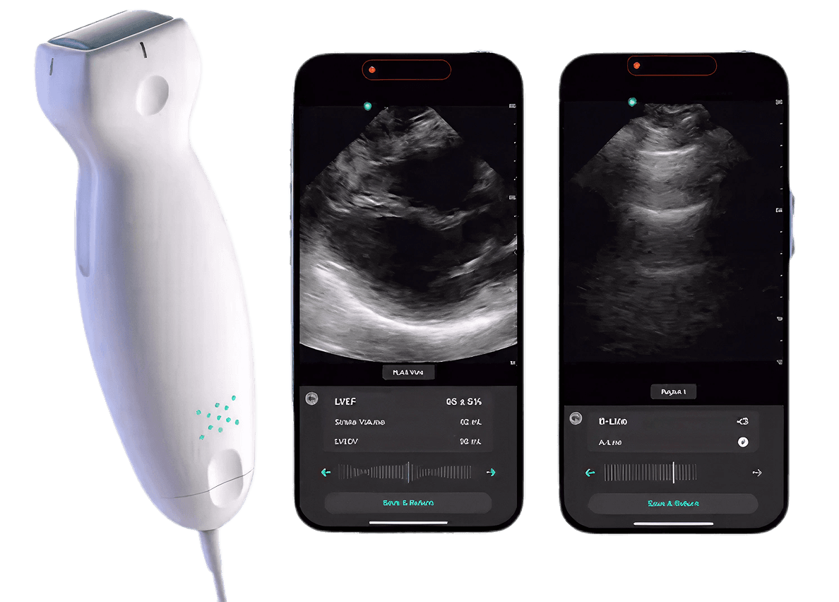 ultrasonic scanner image
